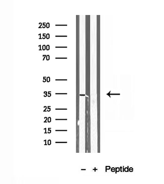SULT1E1 / Sulfotransferase 1E1 Antibody - Western blot analysis of extracts of human adrenal gland tissue using SULT1E1 antibody.