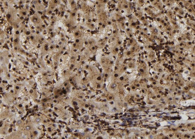 SULT1E1 / Sulfotransferase 1E1 Antibody - 1:100 staining human liver tissue by IHC-P. The sample was formaldehyde fixed and a heat mediated antigen retrieval step in citrate buffer was performed. The sample was then blocked and incubated with the antibody for 1.5 hours at 22°C. An HRP conjugated goat anti-rabbit antibody was used as the secondary.
