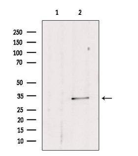 SULT1E1 / Sulfotransferase 1E1 Antibody - Western blot analysis of extracts of mouse lung using SULT1E1 antibody. Lane 1 was treated with the blocking peptide.