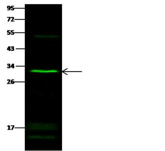 SULT1E1 / Sulfotransferase 1E1 Antibody - Anti-SULT1E1 rabbit polyclonal antibody at 1:500 dilution. Lane A: Jurkat Whole Cell Lysate. Lysates/proteins at 30 ug per lane. Secondary: Goat Anti-Rabbit IgG H&L (Dylight 800) at 1/10000 dilution. Developed using the Odyssey technique. Performed under reducing conditions. Predicted band size: 32 kDa. Observed band size: 30 kDa.