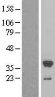 SULT1E1 / Sulfotransferase 1E1 Protein - Western validation with an anti-DDK antibody * L: Control HEK293 lysate R: Over-expression lysate
