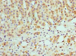 SULT2A1 / Sulfotransferase 2A1 Antibody - Immunohistochemistry of paraffin-embedded human paranephros using antibody at 1:100 dilution.