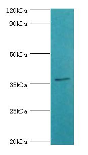 SULT2A1 / Sulfotransferase 2A1 Antibody - Western blot. All lanes: Bile salt sulfotransferase antibody at 5 ug/ml+HepG2 whole cell lysate. Secondary antibody: Goat polyclonal to rabbit at 1:10000 dilution. Predicted band size: 38 kDa. Observed band size: 38 kDa.