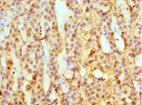 SULT2A1 / Sulfotransferase 2A1 Antibody - Immunohistochemistry of paraffin-embedded human adrenal gland using antibody at 1:100 dilution.