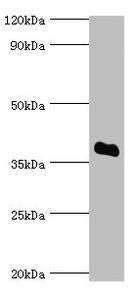 SULT2A1 / Sulfotransferase 2A1 Antibody - Western blot All lanes: Bile salt sulfotransferase antibody at 5µg/ml + HepG2 whole cell lysate Secondary Goat polyclonal to rabbit IgG at 1/10000 dilution Predicted band size: 38 kDa Observed band size: 38 kDa