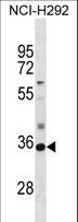 SULT2A1 / Sulfotransferase 2A1 Antibody - SULT2A1 Antibody western blot of NCI-H292 cell line lysates (35 ug/lane). The SULT2A1 antibody detected the SULT2A1 protein (arrow).