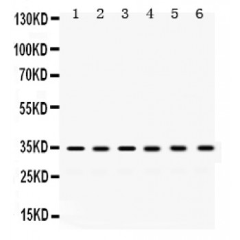 SULT2A1 / Sulfotransferase 2A1 Antibody - SULT2A1 antibody Western blot. All lanes: Anti SULT2A1 at 0.5 ug/ml. Lane 1: Rat Liver Tissue Lysate at 50 ug. Lane 2: Rat Kidney Tissue Lysate at 50 ug. Lane 3: Mouse Liver Tissue Lysate at 50 ug. Lane 4: Mouse Kidney Tissue Lysate at 50 ug. Lane 5: HELA Whole Cell Lysate at 40 ug. Lane 6: SW620 Whole Cell Lysate at 40 ug. Predicted band size: 34 kD. Observed band size: 34 kD.
