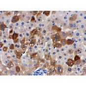 SULT2A1 / Sulfotransferase 2A1 Antibody - SULT2A1 antibody IHC-paraffin. IHC(P): Mouse Liver Tissue.