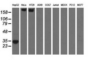 SULT2A1 / Sulfotransferase 2A1 Antibody - Western blot of extracts (35 ug) from 9 different cell lines by using anti-SULT2A1 monoclonal antibody.