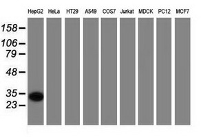 SULT2A1 / Sulfotransferase 2A1 Antibody - Western blot of extracts (35 ug) from 9 different cell lines by using anti-SULT2A1 monoclonal antibody (HepG2: human; HeLa: human; SVT2: mouse; A549: human; COS7: monkey; Jurkat: human; MDCK: canine; PC12: rat; MCF7: human).
