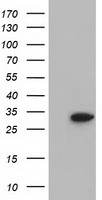 SULT2A1 / Sulfotransferase 2A1 Antibody - HEK293T cells were transfected with the pCMV6-ENTRY control (Left lane) or pCMV6-ENTRY SULT2A1 (Right lane) cDNA for 48 hrs and lysed. Equivalent amounts of cell lysates (5 ug per lane) were separated by SDS-PAGE and immunoblotted with anti-SULT2A1.