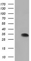 SULT2A1 / Sulfotransferase 2A1 Antibody - HEK293T cells were transfected with the pCMV6-ENTRY control (Left lane) or pCMV6-ENTRY SULT2A1 (Right lane) cDNA for 48 hrs and lysed. Equivalent amounts of cell lysates (5 ug per lane) were separated by SDS-PAGE and immunoblotted with anti-SULT2A1.