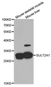 SULT2A1 / Sulfotransferase 2A1 Antibody - Western blot analysis of extracts of various cell lines.