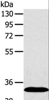 SULT2A1 / Sulfotransferase 2A1 Antibody - Western blot analysis of Human fetal liver tissue, using SULT2A1 Polyclonal Antibody at dilution of 1:650.