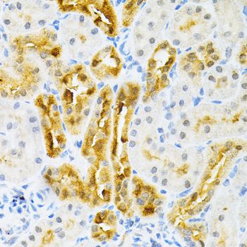 SULT2A1 / Sulfotransferase 2A1 Antibody - Immunohistochemistry of paraffin-embedded rat kidney using SULT2A1 Antibody at dilution of 1:200 (40x lens).