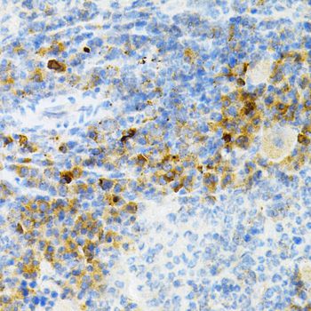 SULT2A1 / Sulfotransferase 2A1 Antibody - Immunohistochemistry of paraffin-embedded mouse spleen using SULT2A1 Antibody at dilution of 1:200 (40x lens).