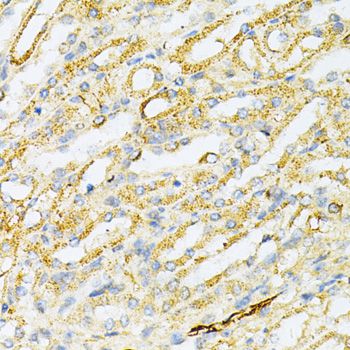 SULT2A1 / Sulfotransferase 2A1 Antibody - Immunohistochemistry of paraffin-embedded mouse kidney using SULT2A1 Antibody at dilution of 1:200 (40x lens).