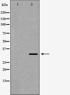 SULT2A1 / Sulfotransferase 2A1 Antibody - Western blot analysis of HeLa cell lysates using SULT2A1 antibody. The lane on the left is treated with the antigen-specific peptide.