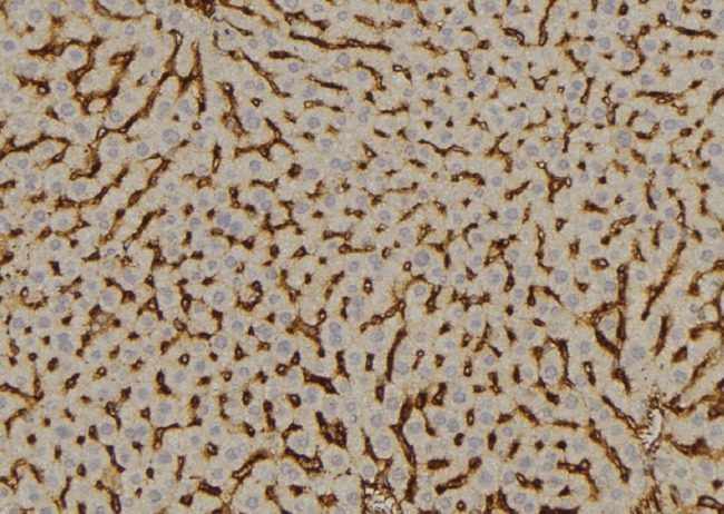 SULT2A1 / Sulfotransferase 2A1 Antibody - 1:100 staining mouse liver tissue by IHC-P. The sample was formaldehyde fixed and a heat mediated antigen retrieval step in citrate buffer was performed. The sample was then blocked and incubated with the antibody for 1.5 hours at 22°C. An HRP conjugated goat anti-rabbit antibody was used as the secondary.