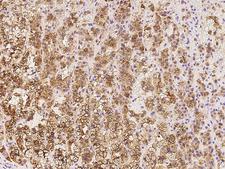 SULT2A1 / Sulfotransferase 2A1 Antibody - Immunochemical staining of human SULT2A1 in human adrenal gland with rabbit polyclonal antibody at 1:10000 dilution, formalin-fixed paraffin embedded sections.