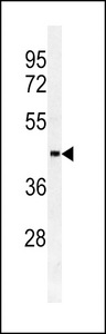 SULT2B1 / Sulfotransferase 2B1 Antibody - Western blot of SULT2B1a/b antibody in HL60 cell line lysates (35 ug/lane). SULT2B1a/b (arrow) was detected using the purified antibody.