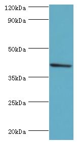 SULT2B1 / Sulfotransferase 2B1 Antibody - Western blot. All lanes: Sulfotransferase family cytosolic 2B member 1 antibody at 4 ug/ml+MCF-7 whole cell lysate. Secondary antibody: Goat polyclonal to rabbit at 1:10000 dilution. Predicted band size: 41 kDa. Observed band size: 41 kDa Immunohistochemistry.