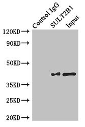 SULT2B1 / Sulfotransferase 2B1 Antibody - Immunoprecipitating SULT2B1 in MCF-7 whole cell lysate Lane 1: Rabbit monoclonal IgG (1µg) instead of SULT2B1 Antibody in MCF-7 whole cell lysate.For western blotting, a HRP-conjugated anti-rabbit IgG, specific to the non-reduced form of IgG was used as the Secondary antibody (1/50000) Lane 2: SULT2B1 Antibody (4µg) + MCF-7 whole cell lysate (500µg) Lane 3: MCF-7 whole cell lysate (20µg)