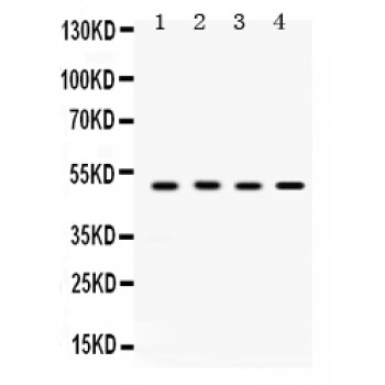 SULT2B1 / Sulfotransferase 2B1 Antibody - SULT2B1 antibody Western blot. All lanes: Anti SULT2B1 at 0.5 ug/ml. Lane 1: Rat Testis Tissue Lysate at 50 ug. Lane 2: A431 Whole Cell Lysate at 40 ug. Lane 3: HELA Whole Cell Lysate at 40 ug. Lane 4: MCF-7 Whole Cell Lysate at 40 ug. Predicted band size: 48 kD. Observed band size: 48 kD.