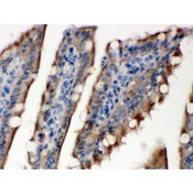 SULT2B1 / Sulfotransferase 2B1 Antibody - SULT2B1 antibody IHC-paraffin. IHC(P): Rat Intestine Tissue.