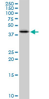 SULT2B1 / Sulfotransferase 2B1 Antibody - SULT2B1 monoclonal antibody (M03), clone 2E5. Western Blot analysis of SULT2B1 expression in MCF-7.