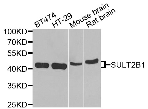 SULT2B1 / Sulfotransferase 2B1 Antibody - Western blot analysis of extracts of various cells.