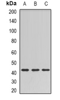 SULT2B1 / Sulfotransferase 2B1 Antibody - Western blot analysis of SULT2B1 expression in HT29 (A); mouse brain (B); rat brain (C) whole cell lysates.