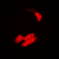 SULT2B1 / Sulfotransferase 2B1 Antibody - Immunofluorescent analysis of SULT2B1 staining in A549 cells. Formalin-fixed cells were permeabilized with 0.1% Triton X-100 in TBS for 5-10 minutes and blocked with 3% BSA-PBS for 30 minutes at room temperature. Cells were probed with the primary antibody in 3% BSA-PBS and incubated overnight at 4 deg C in a humidified chamber. Cells were washed with PBST and incubated with a DyLight 594-conjugated secondary antibody (red) in PBS at room temperature in the dark.