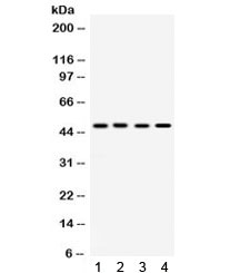 SULT2B1 / Sulfotransferase 2B1 Antibody
