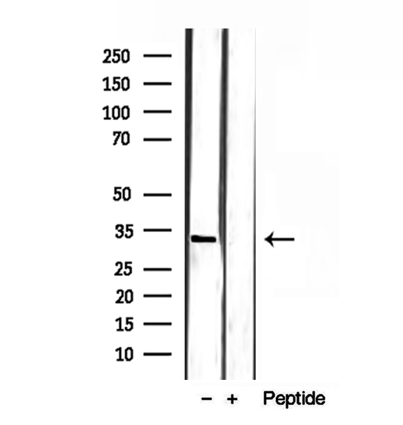 SULT4A1 / Sulfotransferase 4A1 Antibody - Western blot analysis of extracts of rat brain tissue using SULT4A1 antibody.