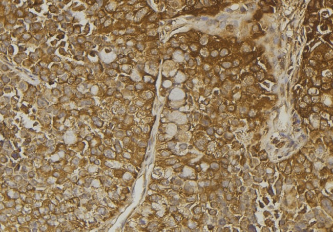 SULT4A1 / Sulfotransferase 4A1 Antibody - 1:100 staining human pancreas tissue by IHC-P. The sample was formaldehyde fixed and a heat mediated antigen retrieval step in citrate buffer was performed. The sample was then blocked and incubated with the antibody for 1.5 hours at 22°C. An HRP conjugated goat anti-rabbit antibody was used as the secondary.