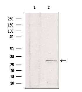 SULT4A1 / Sulfotransferase 4A1 Antibody - Western blot analysis of extracts of rat brain tissue using SULT4A1 antibody. Lane 1 was treated with the blocking peptide.