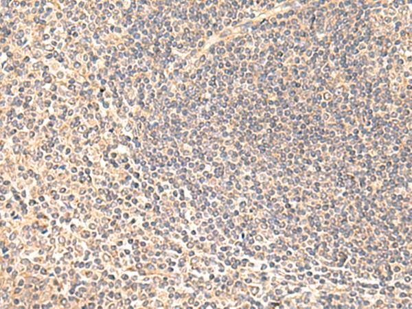 SULT4A1 / Sulfotransferase 4A1 Antibody - Immunohistochemistry of paraffin-embedded Human tonsil tissue  using SULT4A1 Polyclonal Antibody at dilution of 1:65(×200)