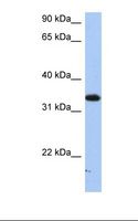 SULT6B1 / Sulfotransferase 6B1 Antibody - HepG2 cell lysate. Antibody concentration: 1.0 ug/ml. Gel concentration: 12%.  This image was taken for the unconjugated form of this product. Other forms have not been tested.