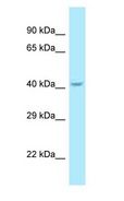 SUMF1 Antibody - SUMF1 antibody Western Blot of Fetal Liver.  This image was taken for the unconjugated form of this product. Other forms have not been tested.