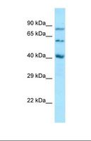 SUMF1 Antibody - Western blot of Human PANC1 Whole cell. SUMF1 antibody dilution 1.0 ug/ml.  This image was taken for the unconjugated form of this product. Other forms have not been tested.