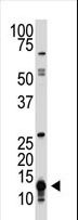SUMO Antibody - The SUMO1 antibody is used in Western blot to detect SUMO1 in HL-60 cell lysate.