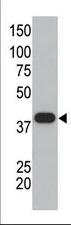 SUMO1 / SMT3 Antibody - The anti-SUMO1 polyclonal antibody is used in Western blot to detect GST-SUMO1 fusion protein.
