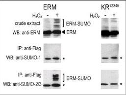 SUMO1 / SMT3 Antibody - COS-7 cells were transfected for 24 hrs with a plasmid expressing FLAG-ERM (left panels) or FLAG-ERM KR12345 (right panels). Untreated (-) and H2O2-treated (+) cells were collected for immunoblot analysis. Top panels: cell lysates probed by western blot (WB) with an anti-ERM antibody. Center panels: cell lysates immunoprecipitated (IP) with an anti-FLAG antibody followed by WB SUMO-1 antibody. Bottom panels: cell lysates immunoprecipitated with an anti-FLAG antibody followed by WB with SUMO-2/3 antibody. (*) represents immunoprecipitated ERM-like forms recognized by anti-SUMO antibodies.