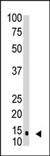 SUMO1 / SMT3 Antibody - The SUMO1 monoclonal antibody is used in Western blot to detect SUMO1 in HL60 cell lysate.