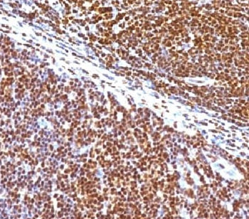 SUMO1 / SMT3 Antibody - IHC staining of human tonsil with SUMO1 antibody (clone S1MT-2).