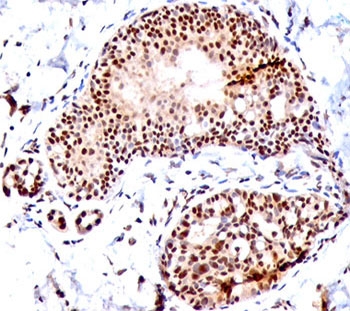 SUMO1 / SMT3 Antibody - SUMO1 antibody SM1/495 immunohistochemistry tonsil.  This image was taken for the unmodified form of this product. Other forms have not been tested.