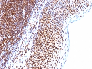 SUMO1 / SMT3 Antibody - Formalin-fixed, paraffin-embedded human tonsil stained with SUMO-1 antibody (SUMO1/1188).  This image was taken for the unmodified form of this product. Other forms have not been tested.