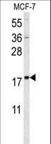 SUMO1 / SMT3 Antibody - Western blot of SUMO1 Antibody in MCF-7 cell line lysates (35 ug/lane). SUMO1 (arrow) was detected using the purified antibody.