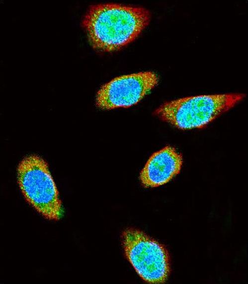 SUMO1 / SMT3 Antibody - Confocal immunofluorescence of SUMO1 Antibody with A375 cell followed by Alexa Fluor 488-conjugated goat anti-rabbit lgG (green). Actin filaments have been labeled with Alexa Fluor 555 phalloidin (red). DAPI was used to stain the cell nuclear (blue).